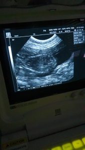 Erstes Ultraschall vom O-Wurf